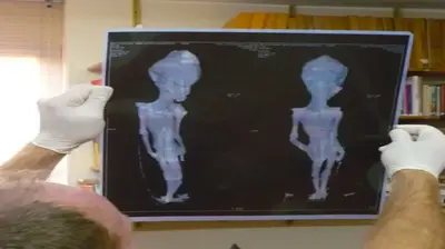 Retired CIA official testified that DNA from Roswell aliens was found in the human genome