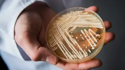Deadly fungus warning as cases spike, prompting Last of Us fears
