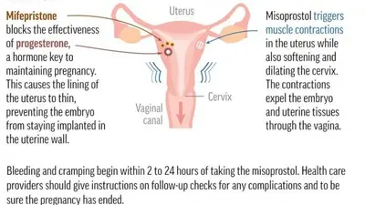 The Supreme Court fight over an abortion pill: What's next?