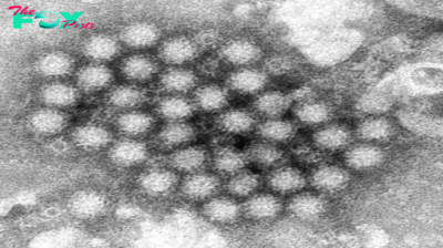 Norovirus Cases Are Rising. Here’s What to Know