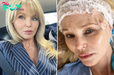 Christie Brinkley reveals skin cancer diagnosis, says she’s ‘lucky’ to have caught it early