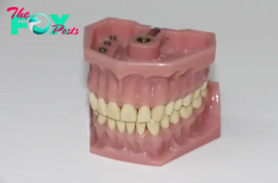 Why a Wax Try in Is Essential for Successful Dental Restorations