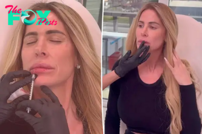 Kim Zolciak roasted for getting lip fillers, Botox amid alleged financial woes: ‘You are in debt up to your eyeballs’