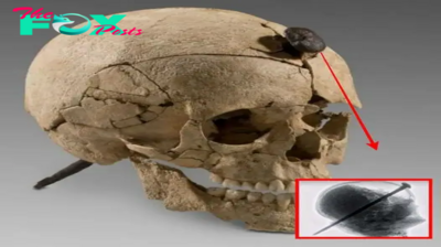 Unveiling History’s Mystery: Iron-Nailed Skull of a Young Ancient Warrior Discovered