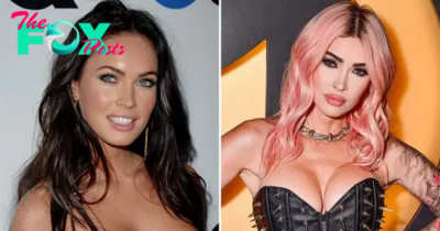Inside Megan Fox’s Plastic Surgery Transformations: See the Before-and-After Photos