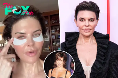 Lisa Rinna admits facial fillers were ‘not good for me’ after critics slammed her look
