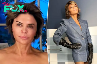 Lisa Rinna bares all to show off spray tan after dissolving her polarizing facial fillers