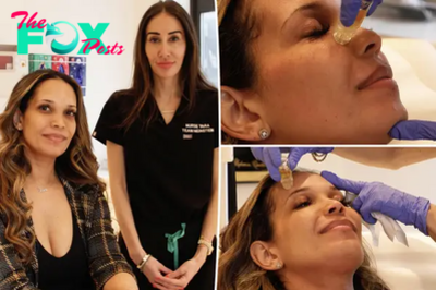 I tried the Botox facial beloved by celebrities