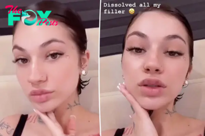 Bhad Bhabie dissolved her fillers, warns people to stop getting them: It makes you look ‘so much older’