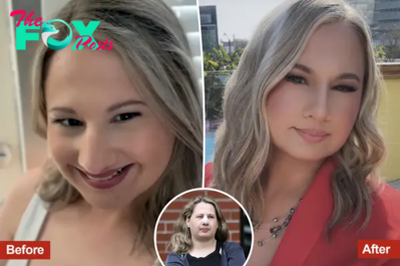 Gypsy Rose Blanchard shows off new nose after getting plastic surgery