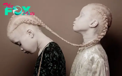 Meet the 11-year-old albino twins who made a strong impression when joining the Storm Fashion World with their charisma and excellent appearance