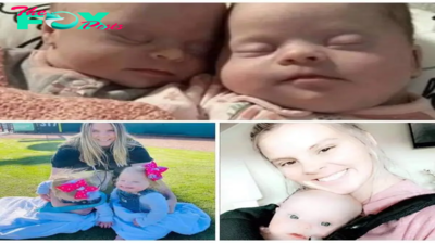Florida mom gives birth to rare set of identical twins with Down syndrome