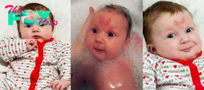 The Valentine’s Day miracle of a newborn baby with a heart-shaped birthmark spreads radiant love and unique beauty.