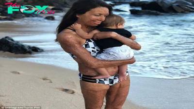 31-year-old Turia Pitt’s happiness when she became a mother. Even though she has an ugly appearance due to an accident, her husband, Michael Hoskin, still loves and pampers her every day.