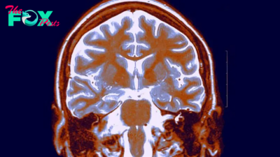 Men have a daily hormone cycle — and it's synced to their brains shrinking from morning to night