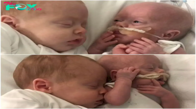 Tiny Fighter: One-Pound Baby’s Endurance Nurtured by Twin Brother’s Cuddles