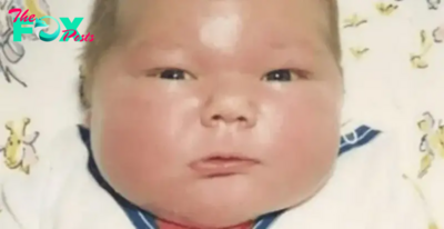 In 1983, a 16-pound baby caught everyone’s attention: You won’t believe what he looks like now!