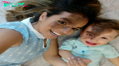 A mother’s love is shown in her decision to use makeup to recreate her son’s birthmark, helping to restore his confidence amid critical stares.