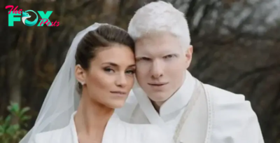 “A future supermodel!” The most handsome albino singer showed his heritage and blew up the network