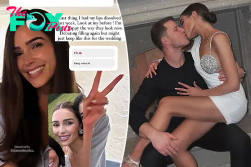 Olivia Culpo reveals she had lip filler dissolved ahead of Christian McCaffrey wedding