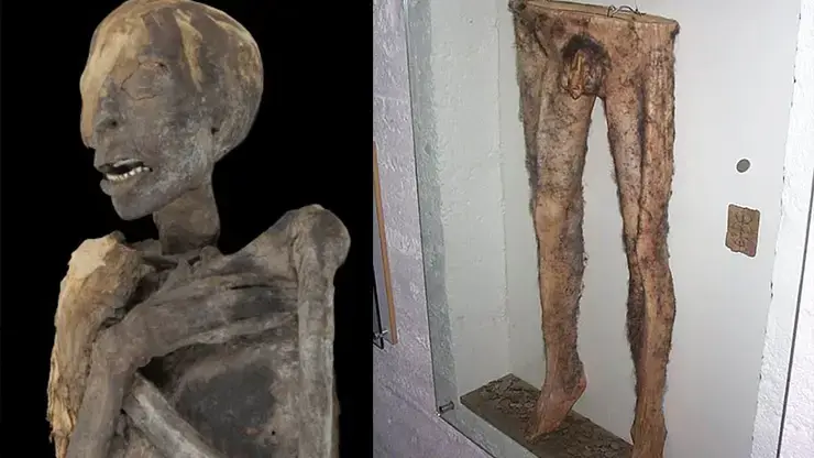 Did Icelandic Sorcerers Really Make Magic Pants Out Of Human Skin?