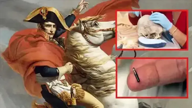 The Mysterious “Alien” Microchip Found In The Skull Of Napoleon Bonaparte