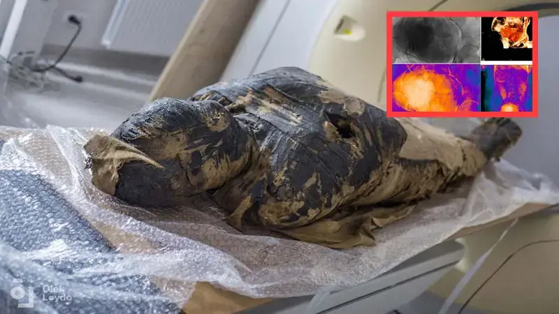 World First! 2,000-Year-Old Egyptian Mummy Was Pregnant