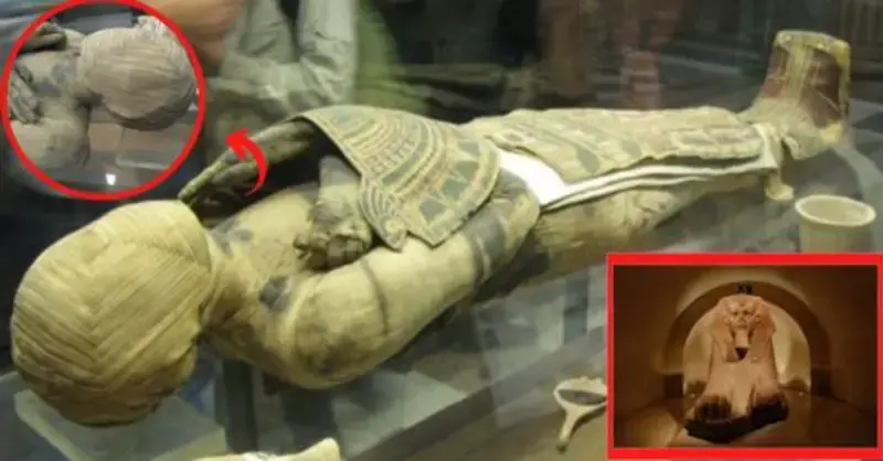 An ancient Egyptian mummy on display at the Louvre has a face-covering that has an unique interwoven square pattern on it