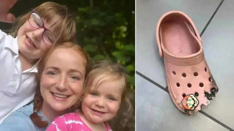 Mother’s warning after rescuing daughter’s foot from shoe-eating escalator