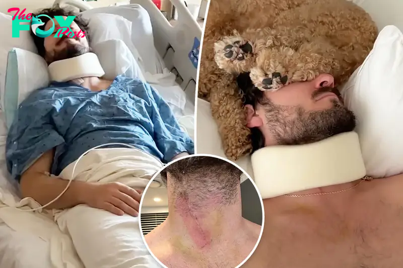 Val Chmerkovskiy shows grisly neck injury that led to hospitalization: ‘I went through some stuff’