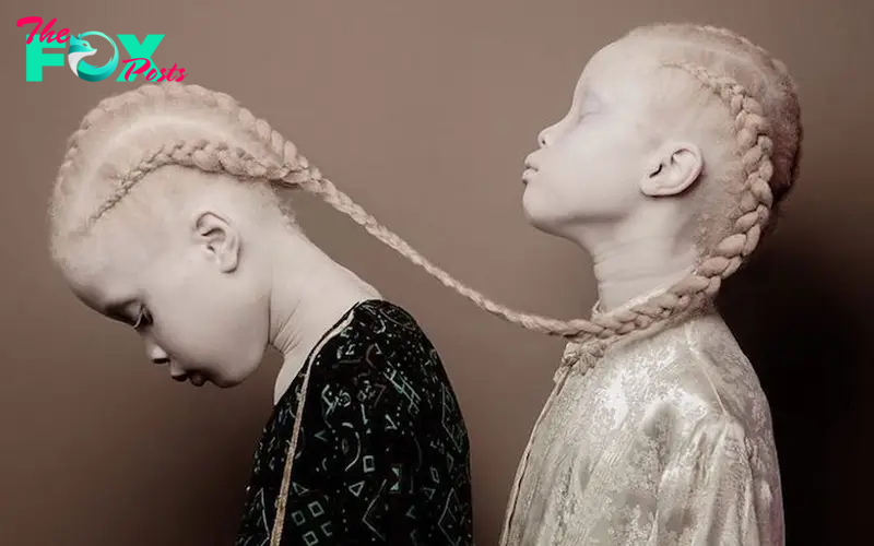 Bomk6 Attracting many people: Adorable albino twins dominate the fashion and beauty realm with their irresistible charm.
