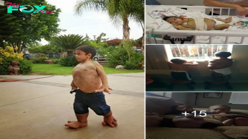 Embracing Extraordinary Limbs: The Remarkable Journey of a Boy Defying Norms