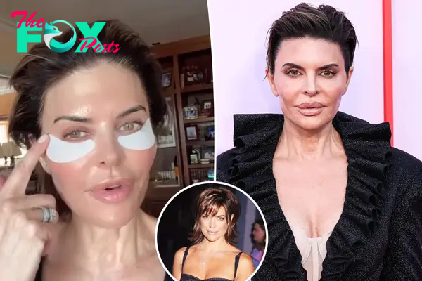 Lisa Rinna admits facial fillers were ‘not good for me’ after critics slammed her look