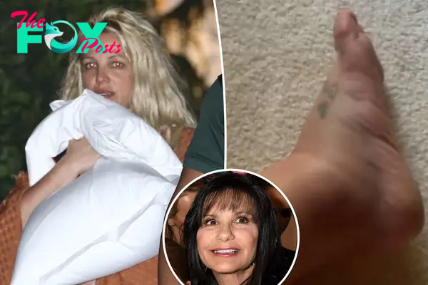 Britney Spears shows off bruised and swollen foot, seemingly blames mom for hotel drama