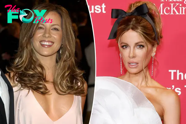 Kate Beckinsale shuts down plastic surgery rumors following her months-long hospital stay