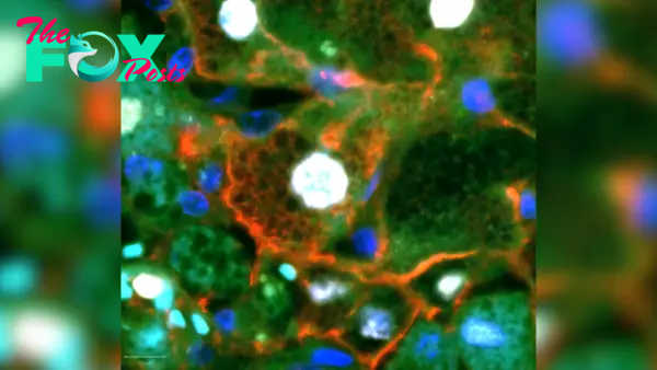 Scientists discover new type of cell in the liver