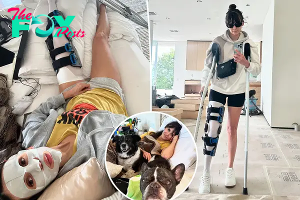 Nina Dobrev shows off injured leg following bike accident: ‘Life looks a lil different lately’