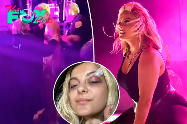 Bebe Rexha boots fan for hurling object at her 1 year after phone-throwing incident left her with black eye