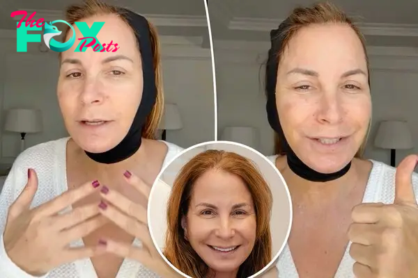 Jill Zarin reveals full ‘facial rejuvenation’ — here’s everything she had done