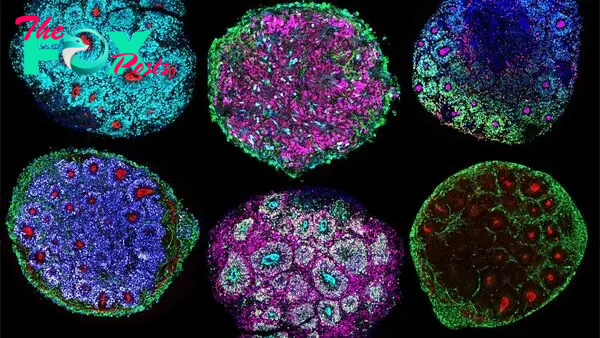 Scientists just grew the 1st-ever 'minibrains' from multiple people's cells