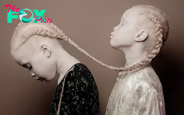 The 11-year-old albino twins left a lasting impact as they became the center of attention in Storm’s fashion world, inspiring with their presence and unique style