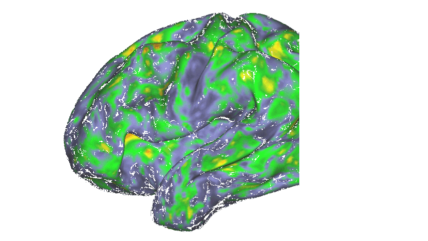 Magic mushrooms temporarily 'dissolve' brain network responsible for sense of self