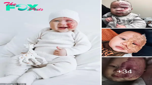 Inspiring the Infant’s Journey from Red Spots to Radiant Beauty Despite Ьіаѕ.sena