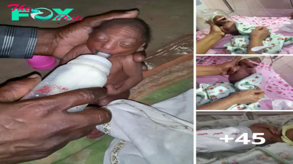 Heartbreaking Abandonment: The Tragic Story of a 2-Week-Old Baby with Prematurely Aged Skin.criss