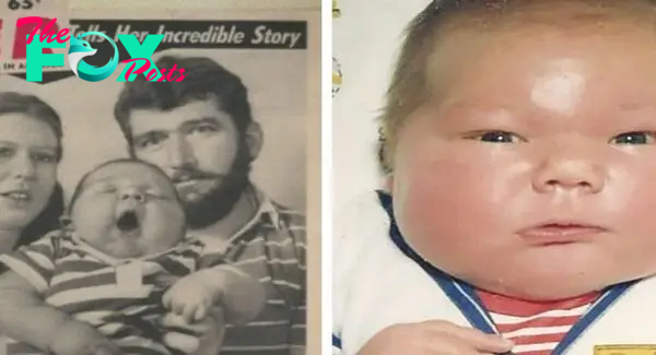 A child weighing 7.2 kg was born in 1983. How is he still alive after 39 years?