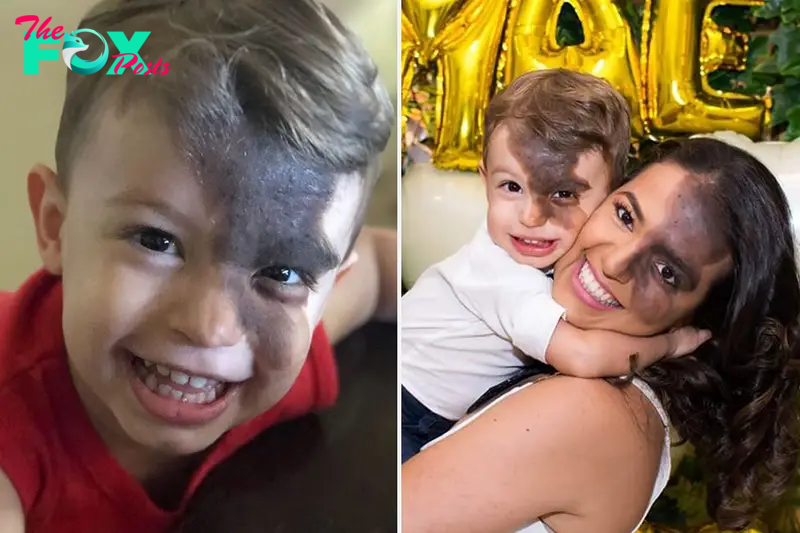 A mother used cosmetics to recreate her son’s birthmark, trying to help him overcome his shyness in the face of judgmental looks from negative individuals outside of society.