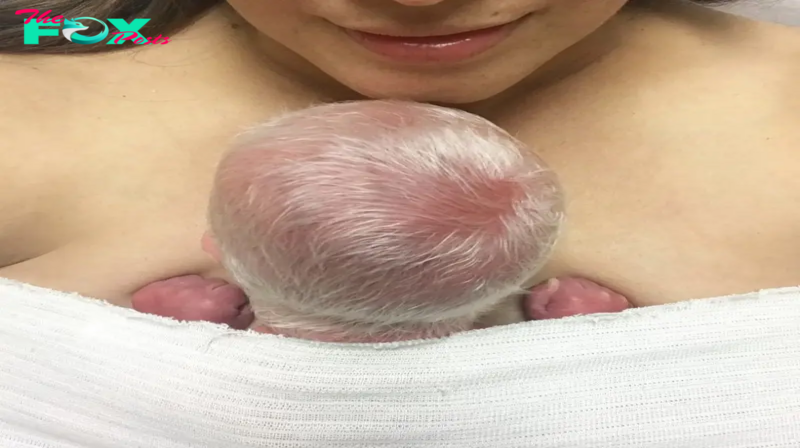 Baby with White Hair Overcomes Challenges and Shines with Happiness