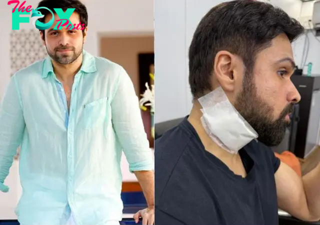 Emraan Hashmi injured on set of ‘Goodachari 2’ while filming action scene